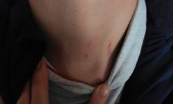 Kayseri’de ilkokul öğrencisini öğretmeni darp etti