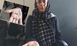 Kayseri’de özel klinikte implant krizi: 2 yıldır dişlerini elinde taşıyor!