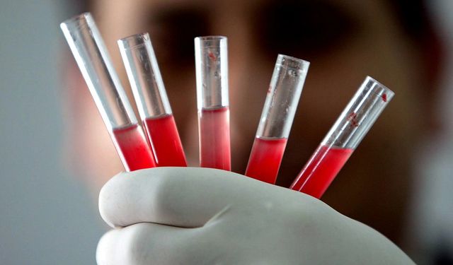 Görünce şaşıracaksınız: Hangi kan grubu daha sağlıklı açıklandı