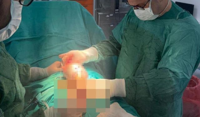 İdrar şikayetiyle gittiği hastanede testisinden çıkan şok etti!