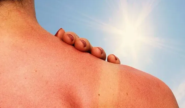 Tatile gitmenize gerek yok: Bu şekilde bronzlaşabilirsiniz
