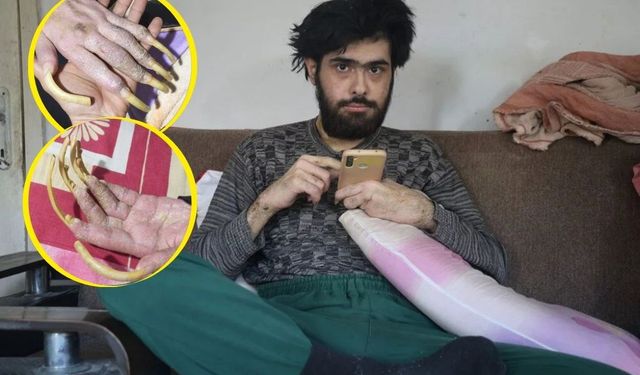 3 yıl sonra duş alıp, tıraş olan Barış'a teşhis kondu!