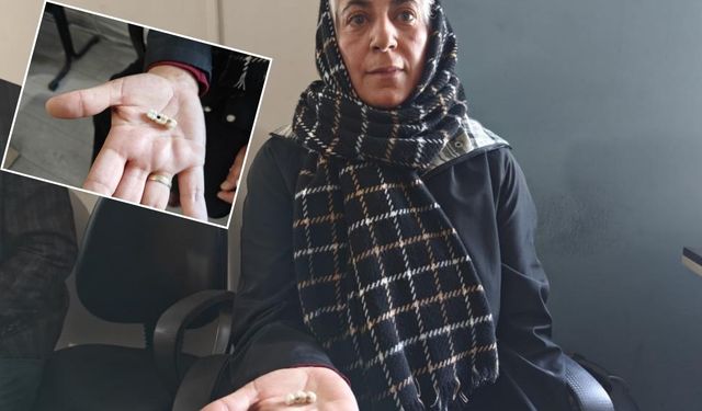 Kayseri’de özel klinikte implant krizi: 2 yıldır dişlerini elinde taşıyor!