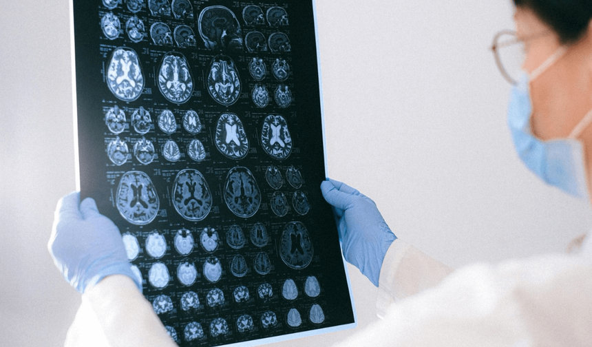 Alzheimer’ın ilk sinyali: Kısa süreli hafıza kaybı