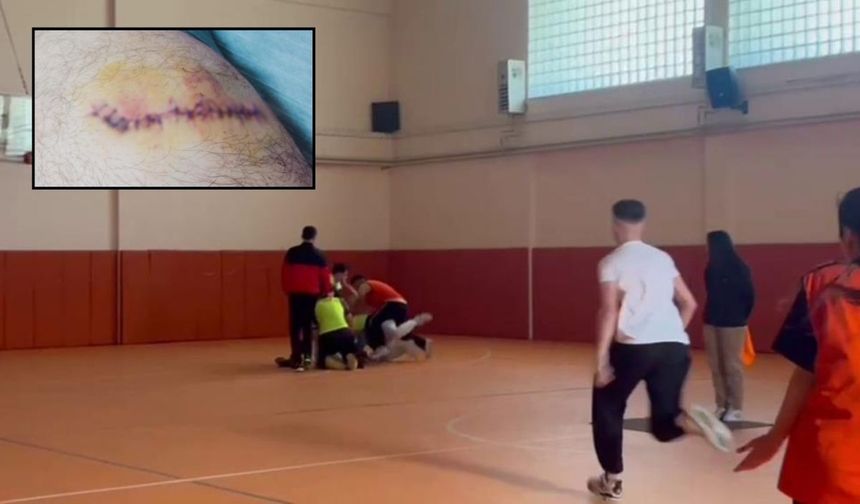 Konya’da okulda başlayan kavga mahalleye taştı: Liseli çocuk bıçaklandı