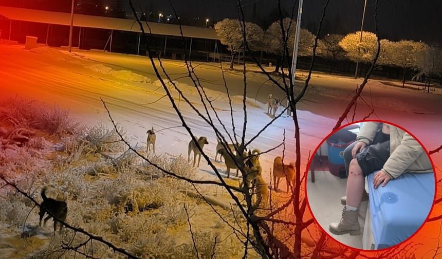 Kayseri'de Sokak Köpeği Saldırısı: Yaralanan kız hastaneye kaldırıldı