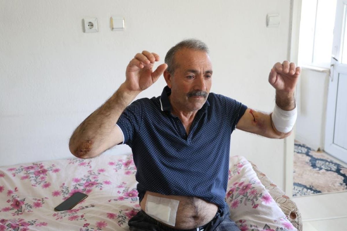 10 Tane Sokak Köpeğinin Saldırısına Uğrayan Adam, Dehşeti Yaşadı! 3