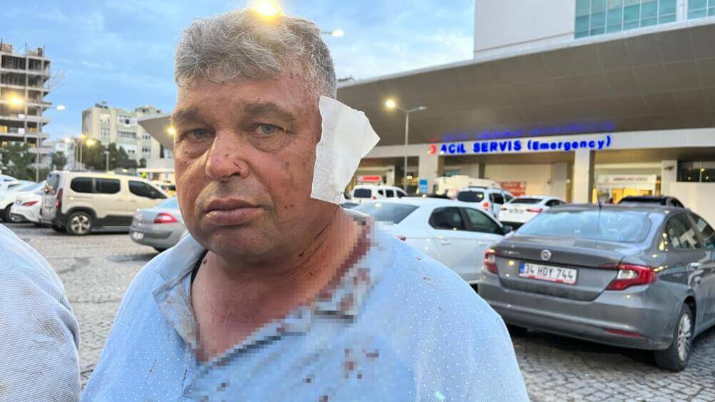 Dolmuş Sürücüsüyle Tartışan Abi Ve Kardeşi Feci Şekilde Darp Edildi!