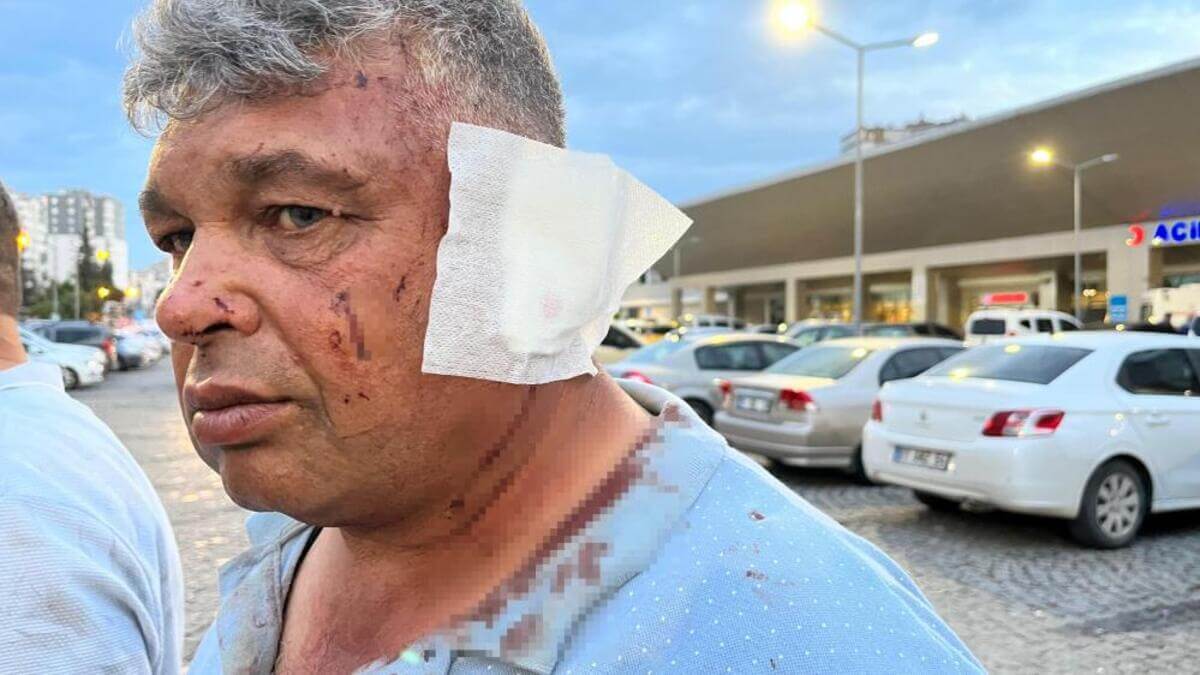 Dolmuş Sürücüsüyle Tartışan Abi Ve Kardeşi Feci Şekilde Darp Edildi!-1