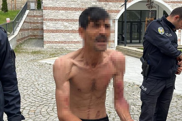 Bolu Kendini Kesen Adam