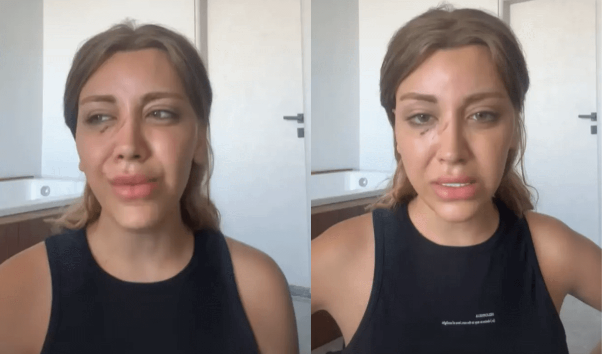 Öldüresiye Dövüldüm Diyen Ünlü Fenomen Saldırının Sebebini Açıkladı!
