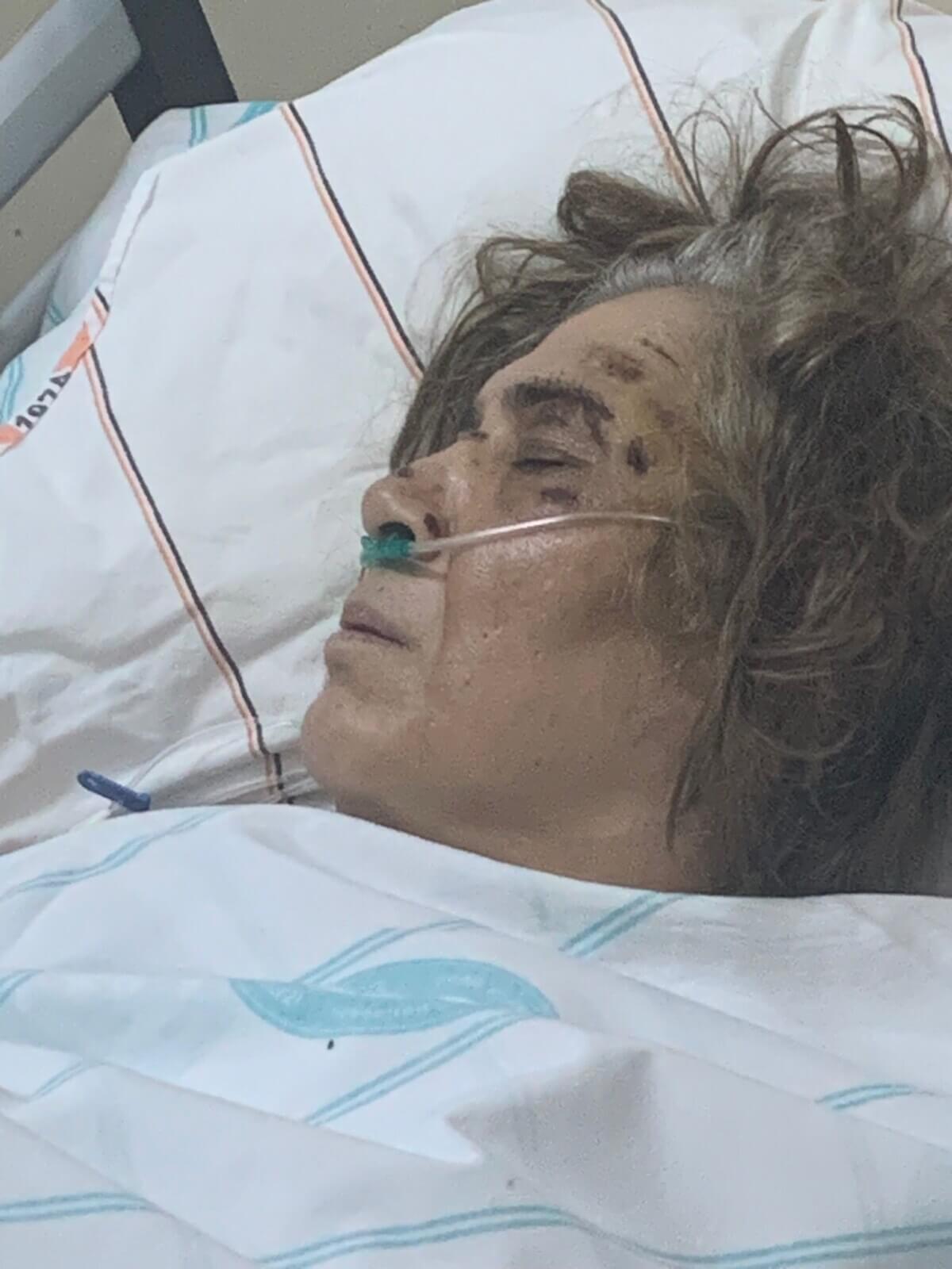 Sivas'ta Ehliyetsiz Sürücünün Çarptığı Yaya Ağır Yaralandı! Gözaltına Bile Alınmadı! (5)