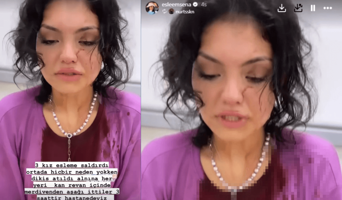 Lacivert Kırmızı Son Dakika Hareketli Instagram Gönderisi 2024 07 09T151109.370 (1)