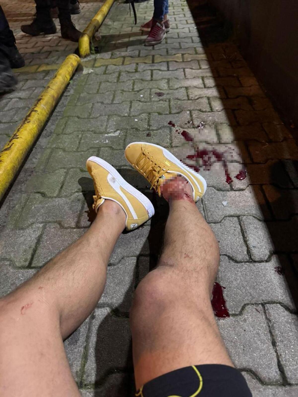 Silahlı Saldırı
