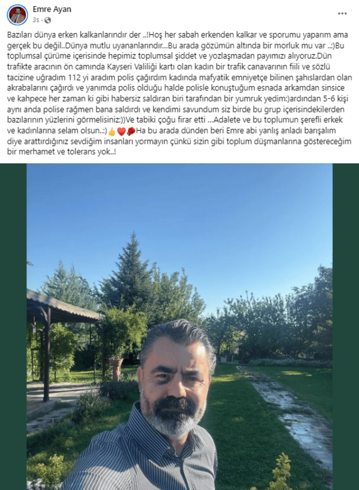 Chp’li Emre Ayan, Kayseri’de Saldırıya Uğradı Arkamdan Sinsice… 2