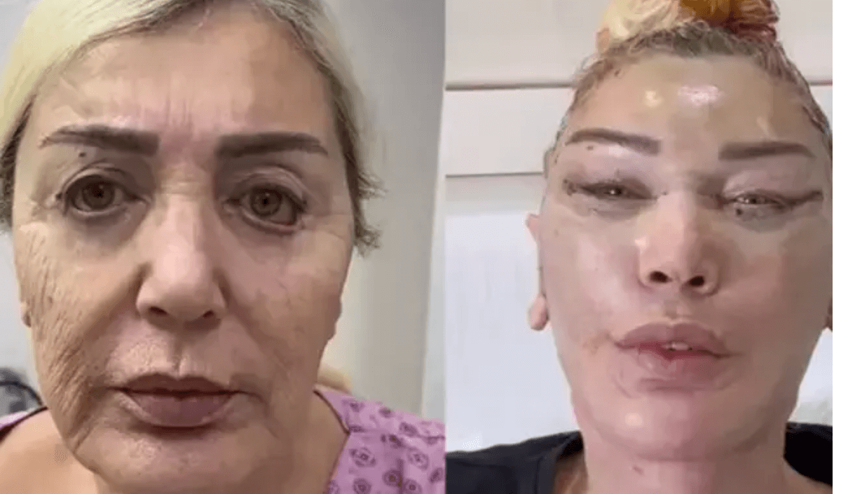 Gençleştirme operasyonu geçiren Seda Sayan'ın ablasını tanıyabilene aşk olsun!