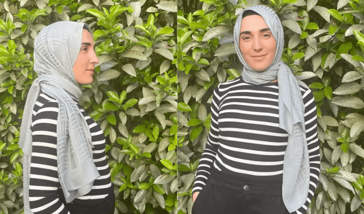 Masterchef Ayşe elenir elenmez estetik mi yaptırdı? Son pozu olay yarattı!