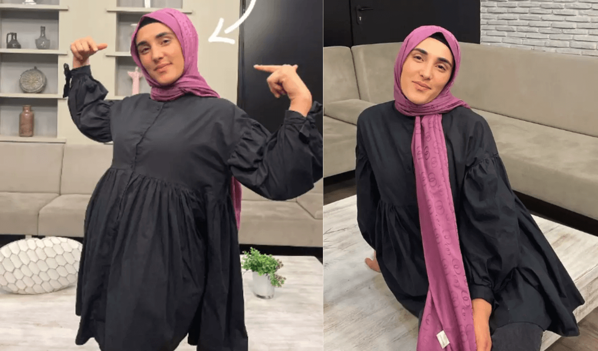 Masterchef Ayşe elenir elenmez estetik mi yaptırdı? Son pozu olay yarattı!
