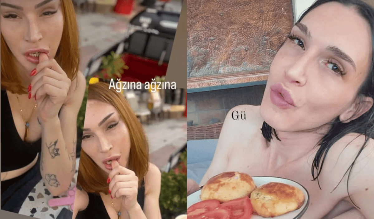 Cinsiyet değiştiren ünlü oyuncu estetiğin dibine vurdu! Görenler şok oldu!