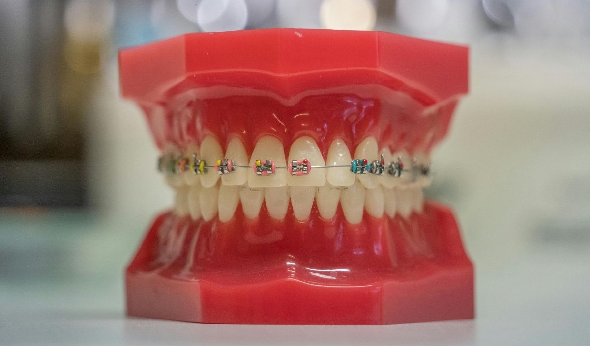 Ortodonti Kayseri 1