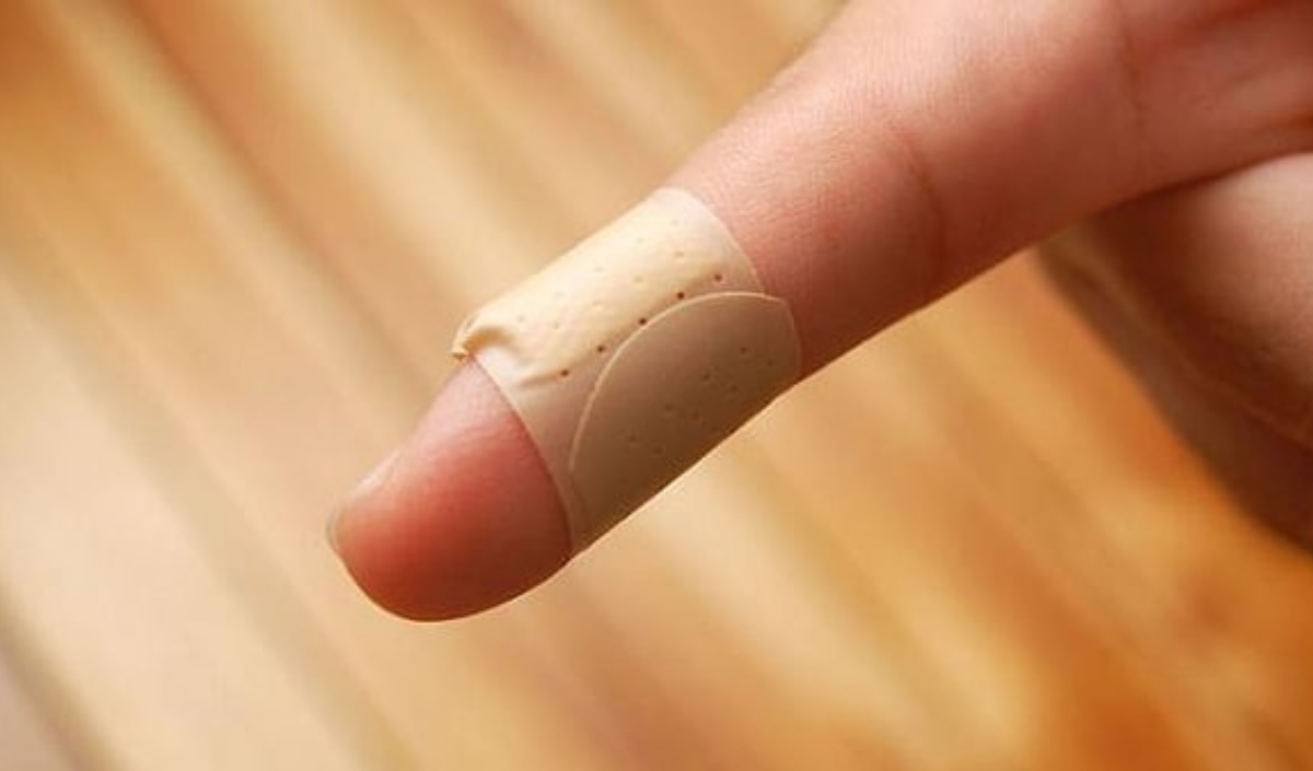 Parmak Kesiklerinde İlk Müdahale Nasıl Olmalı İşte Hayati Öneriler Ve Uzman Tavsiyeleri! 2.