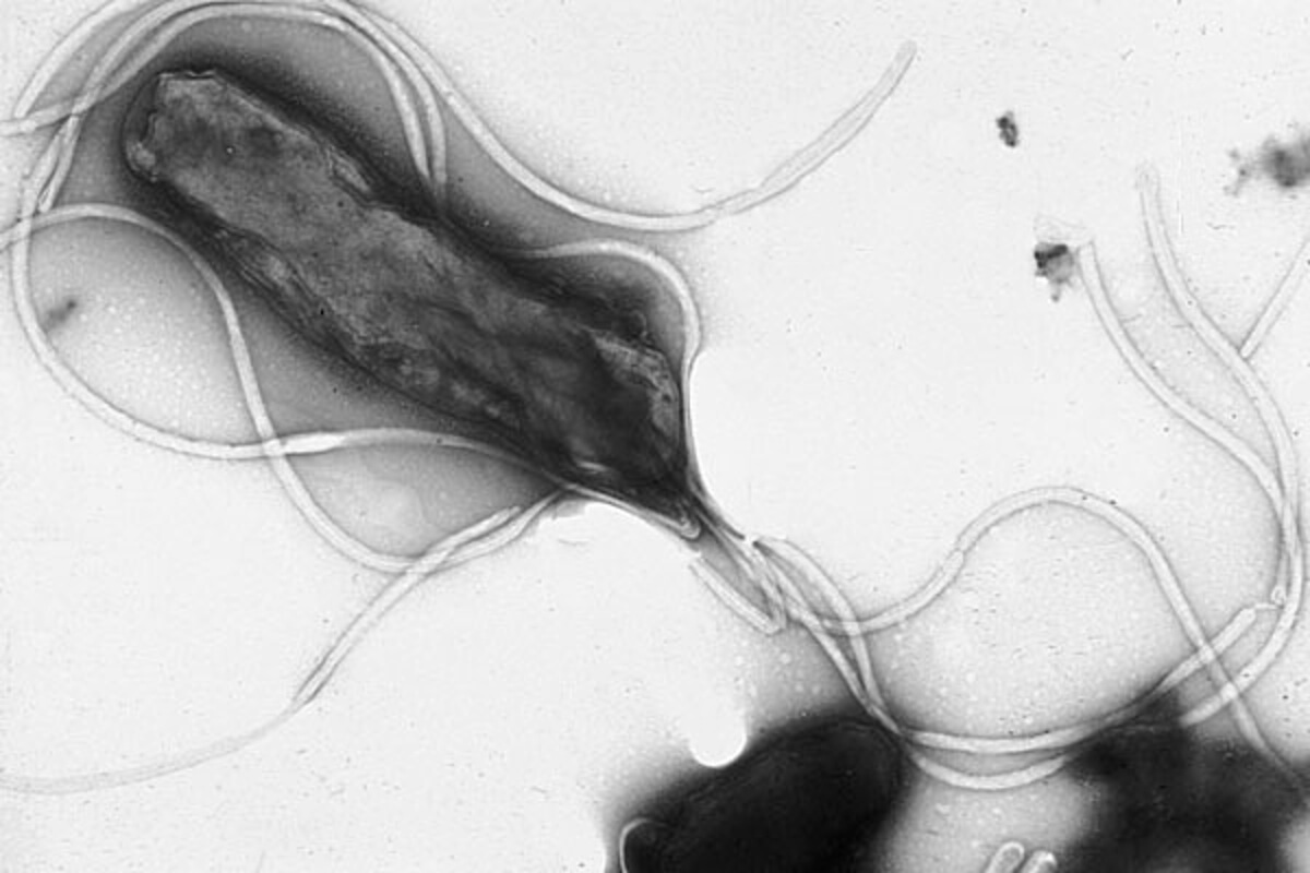 Helicobacter Pylori Midenin Gizli Misafiri (1)