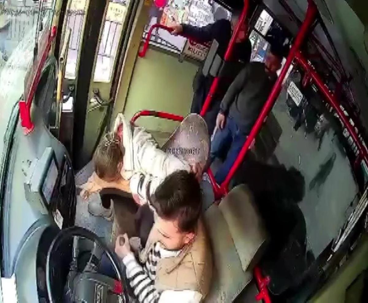 Çocuğunu Göstermediğini Iddia Ettiği Kocasını Önce Isırdı, Sonra Bıçakladı! 1