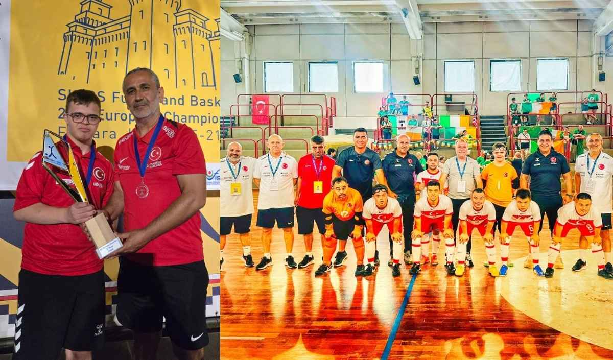 Kayseri Down Sendromu (1)