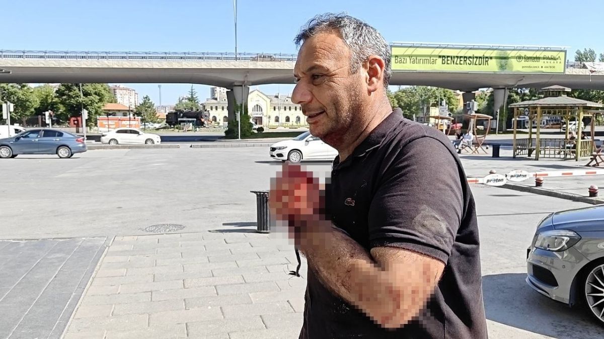 Kayseri'de Değişmeyen Görüntüler! Acemi Kasaplar Hastanenin Yolunu Tuttu (1)
