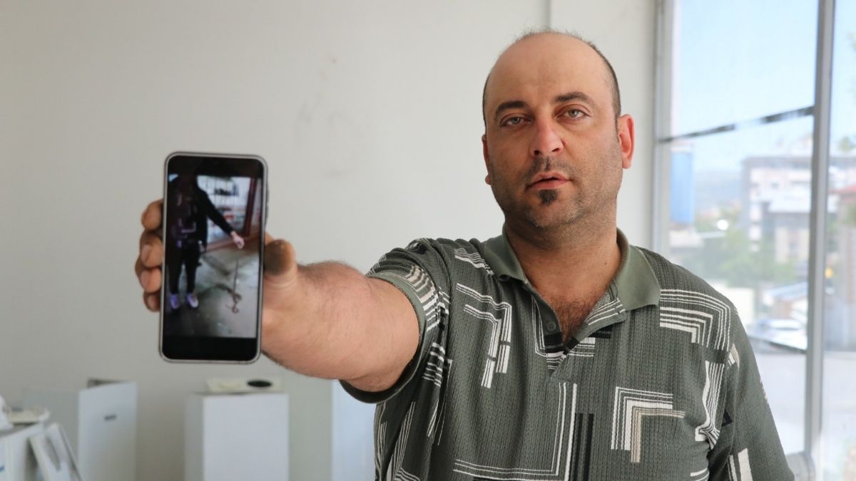 Yılan Sivas Eli Ile Tuttan Vatandaşi (1)
