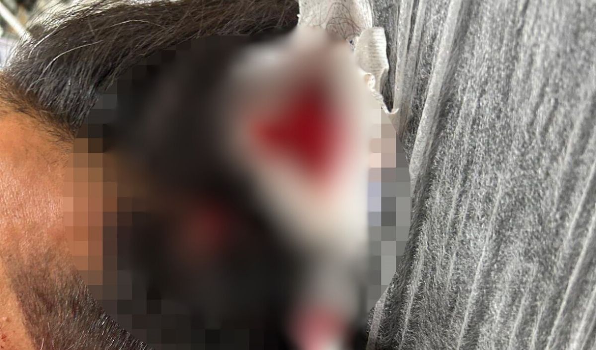 Yorgun Merminin Kurbanı Oldu! Döner Keserken Başına Saplandı (2)