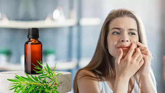Akne
Çay ağacı yağı, antibakteriyel ve anti-inflamatuar özellikleriyle akne tedavisinde sıkça kullanılır. Araştırmalar, hafif aknede iltihabı azaltarak ve akneye neden olan bakterileri hedef alarak yardımcı olabileceğini öne sürüyor. Çeşitli insan çalışmaları umut verici sonuçlar gösterse de, çalışma tasarımlarındaki farklılıklar kesin sonuçlar çıkarmayı zorlaştırıyor. Bir karşılaştırmalı çalışmada, çay ağacı yağı, yaygın bir akne tedavisi olan benzoil peroksit kadar etkili bulunmadı, ancak kuruluk ve tahriş gibi yan etkileri daha azdı.
