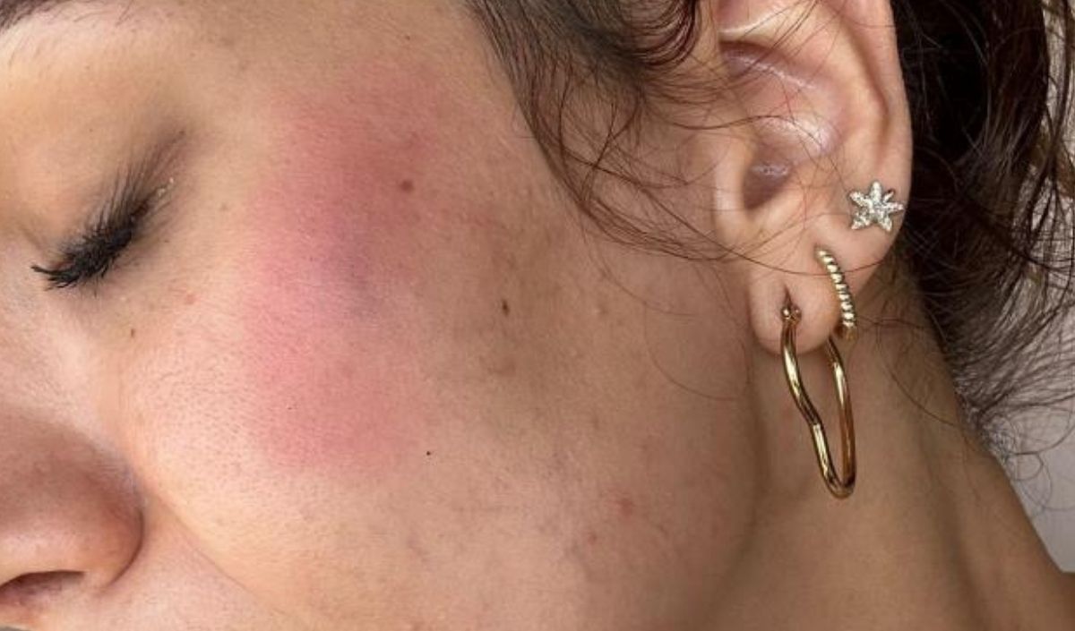 ‘Köpek Beslediniz’ Diyerek Aileyi Darp Ettiler 72 Yaşında Ki Kadının Kaburgaları Kırıldı (1)
