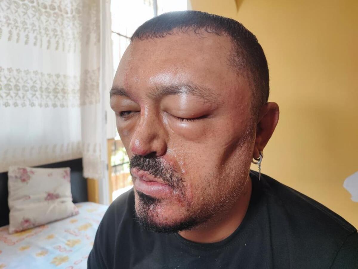 şampuan