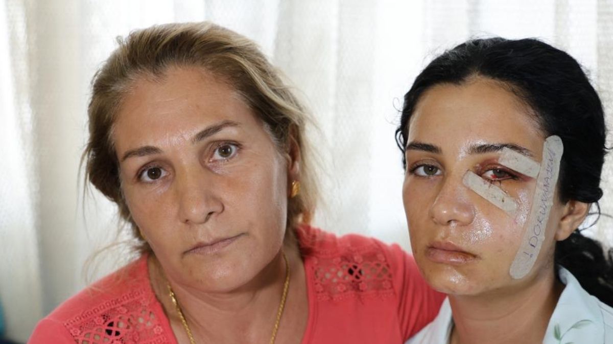 adanada şiddet