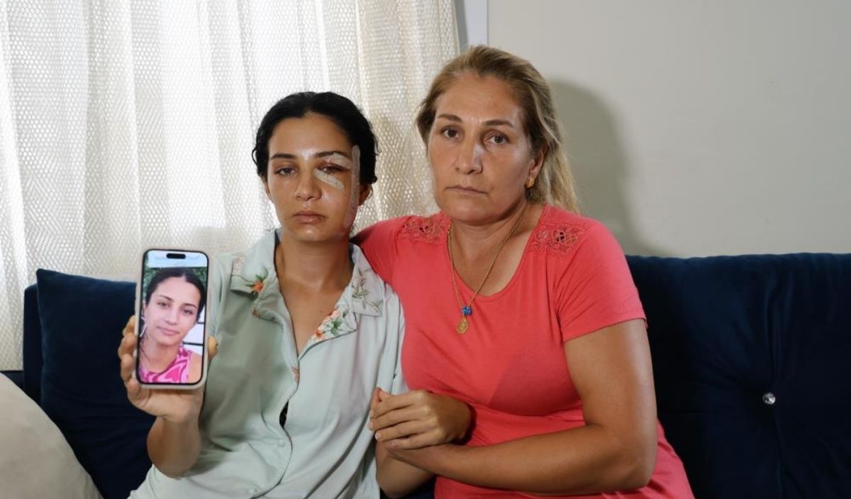 Kızının Gözleri Önünde Şiddet Gören Genç Kadının Hastanede “Merdivenden Düştüm” (2)