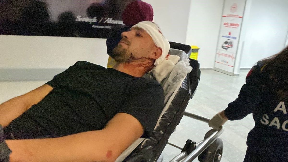 Aksarayda Tasli Soplali Kavga 7 Yarali (2)