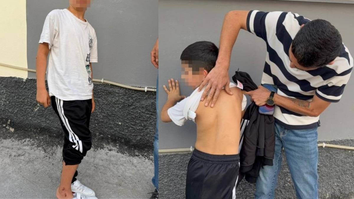 Çocuğu Yere Fırlatan Şüpheli Tutklandı (2)