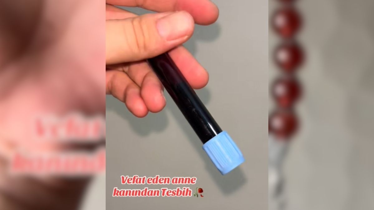 Ölen Anne Kan Tesbi̇h Yapti Neci̇s (2)