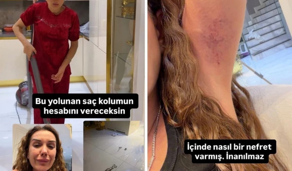 Sıla Doğu Ile Dilan Polat Arasında Kavga! ‘Beni Darp Etti’ (2)