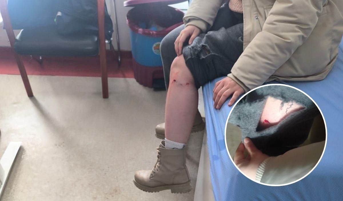 Tomarzadakızçocuğunaköpeksaldırısı