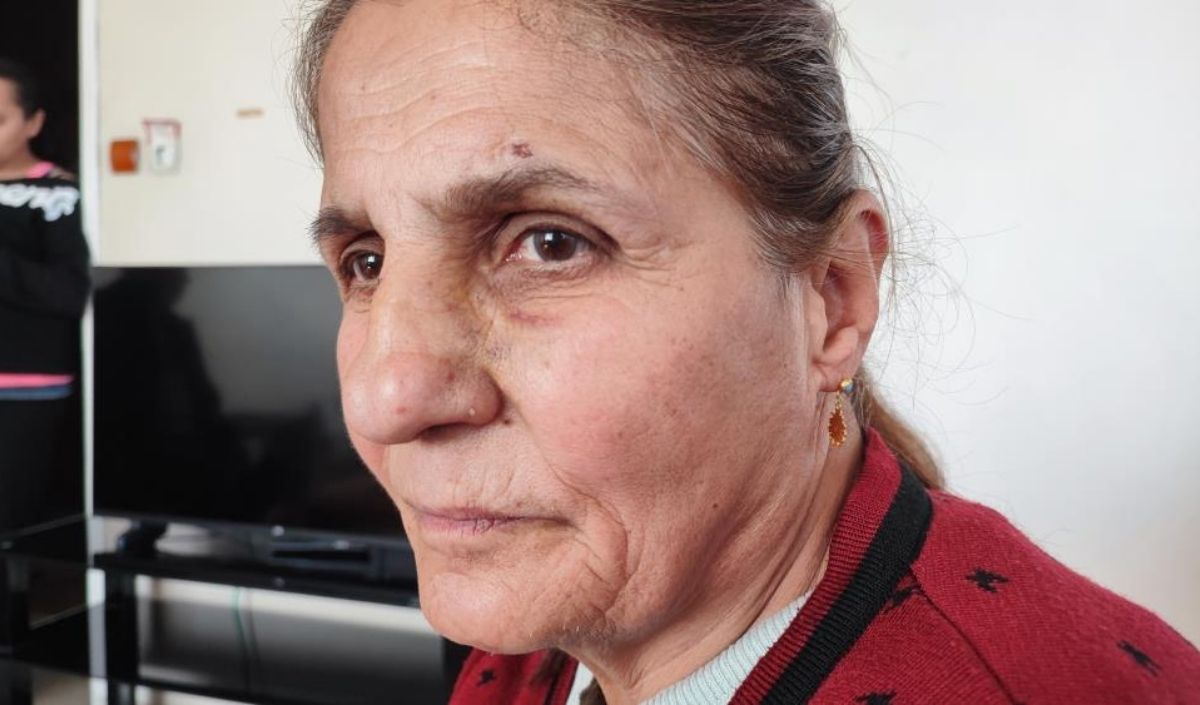 Adana’da Çukura Düşen Kadın Hastanelik Oldu (3)