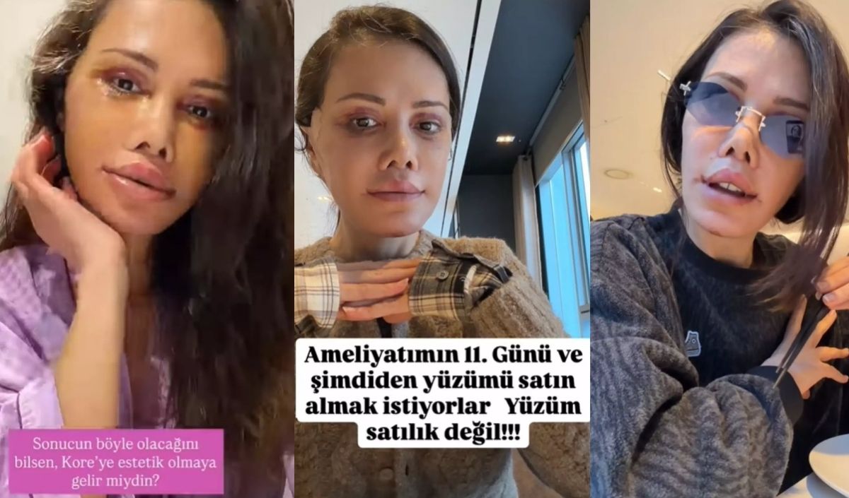 eski survivor yarışmacısı