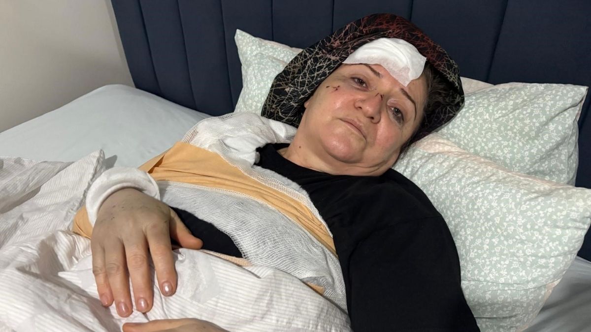 Kayseri Tramvay Kaza (4)