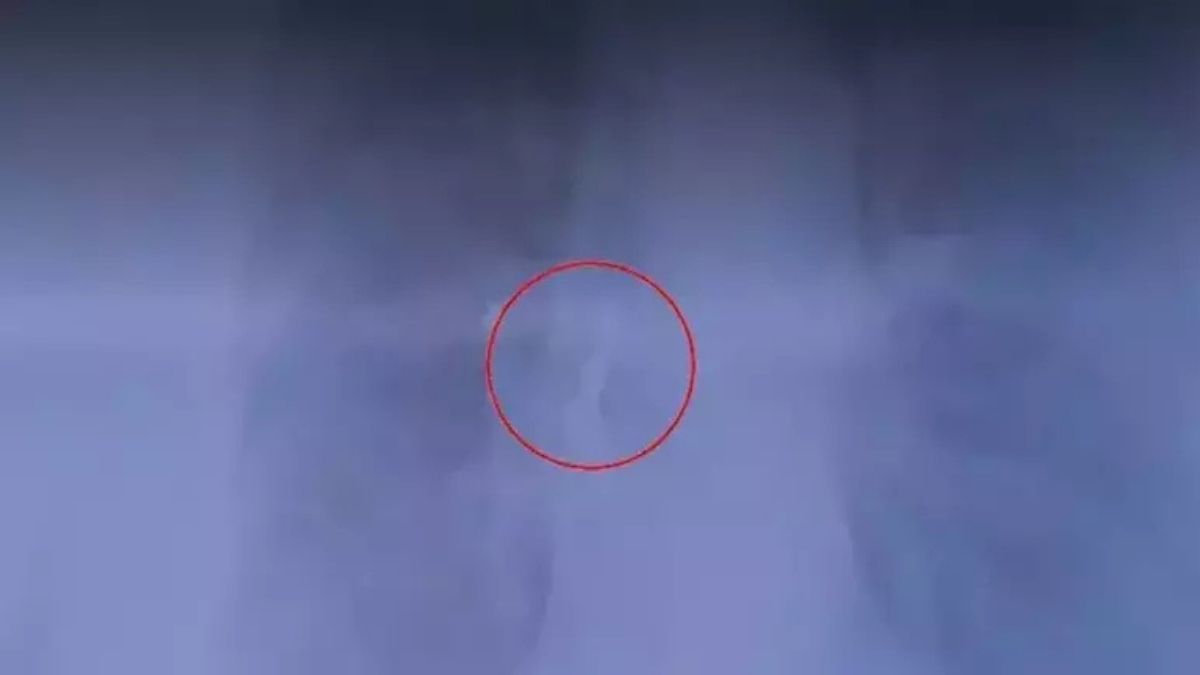 Sabah Aynaya Baktığında Şoke Oldu Gerçek Hastanede Ortaya Çıktı! (2)