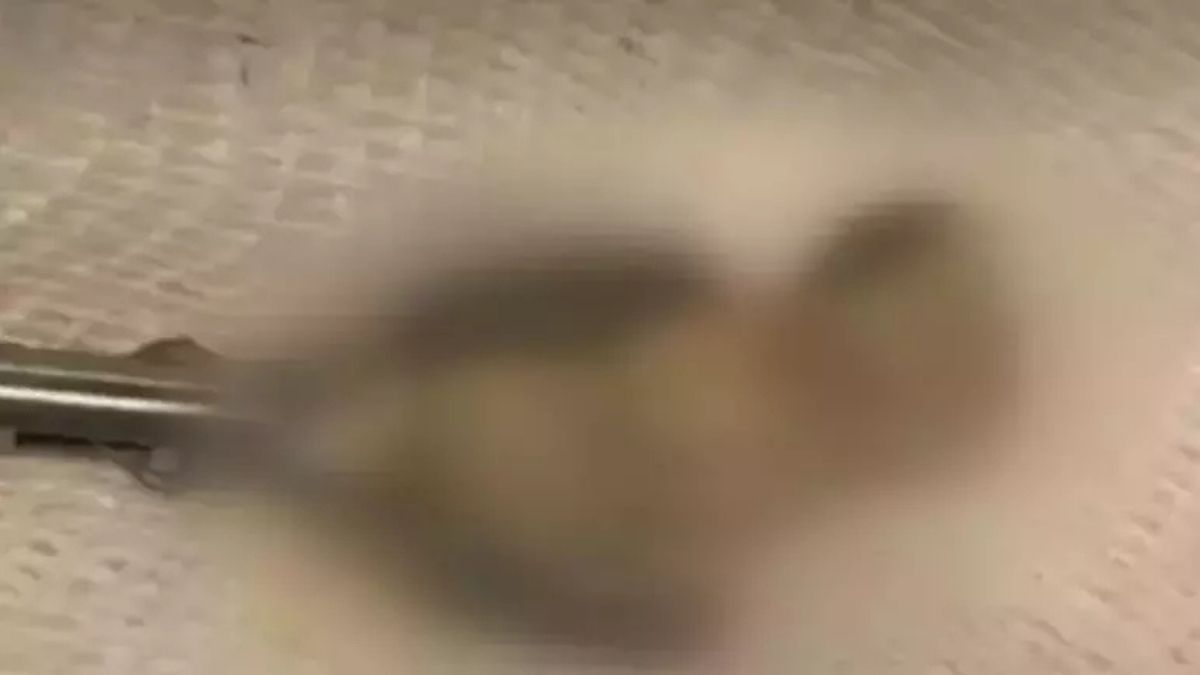 Sabah Aynaya Baktığında Şoke Oldu Gerçek Hastanede Ortaya Çıktı! (3)